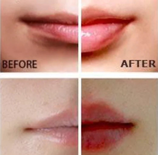Miracle Lip Plumper – Instant Fullness & Hydration with Natural Vasodilation