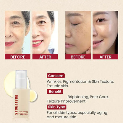 Conjunto de cuidados da pele coreano SEUL 1988 - Creme de olhos com retinol, sérum com ginseng e niacinamida, produto de limpeza, branqueia linhas finas e olheiras